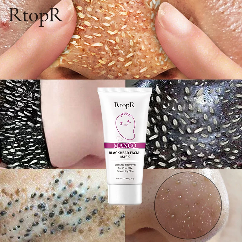 Средство для удаления черных точек с манго лечение акне контроль жирности носа