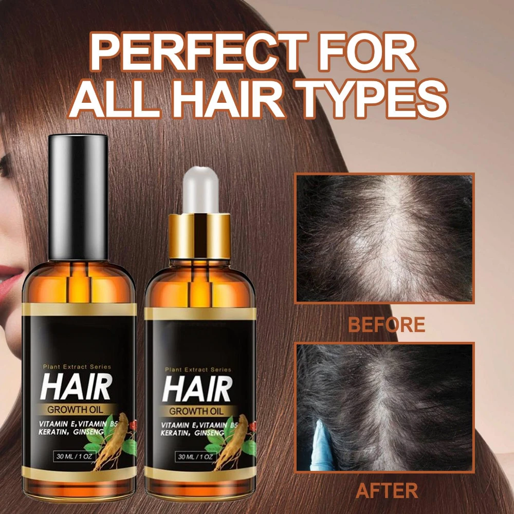 

Botanical Oil Hair Growth Strengthening Essence Hair Reducing Hair Loss Broken Hair Conditioning Oil for Men Women