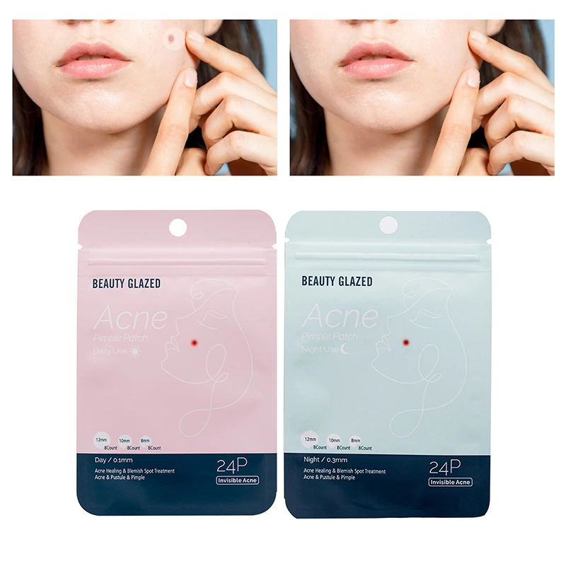 24PCS Acne Pimple Patch Stickers Waterproof Acne Treatment Pimple Remover Tool Blemish Spot Facial Mask Skin Care Gift Beauty