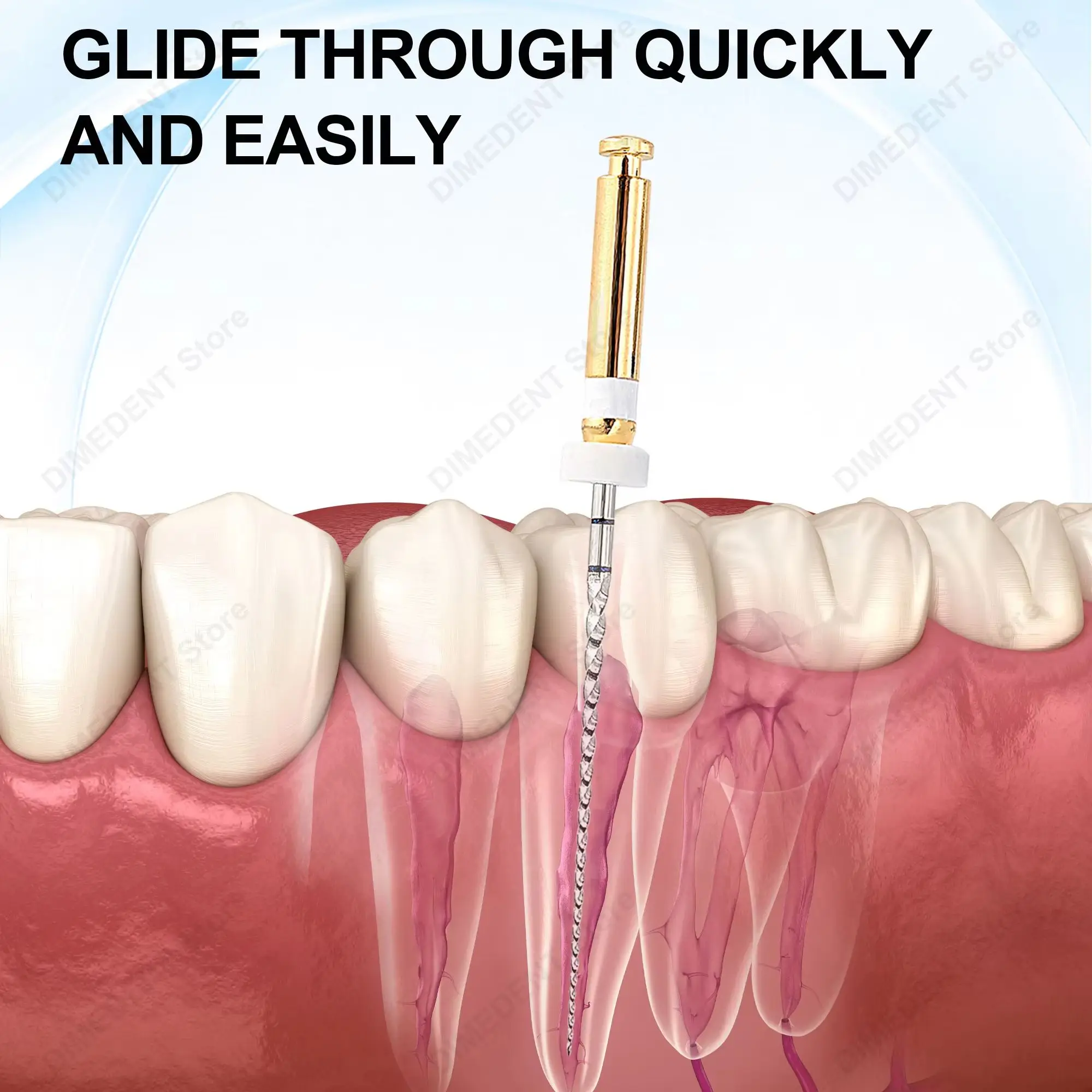 Фото Файлы DIMEDENT Glide Path Niti, 3 шт./упак., роторные эндодонтические файлы 21/25 мм 02/16, для использования с мотором, стоматологические инструменты для корневых каналов №5