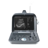pbwu6602 black white imaging pregnancy scanner ultrasound equipment