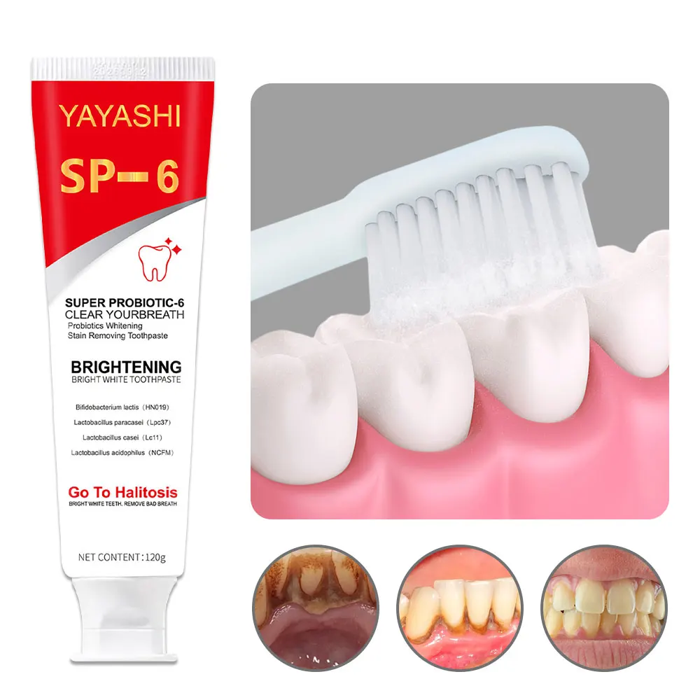 Sp-6 120 г пробиотическая зубная паста отбеливание зубов удаление пятен налета
