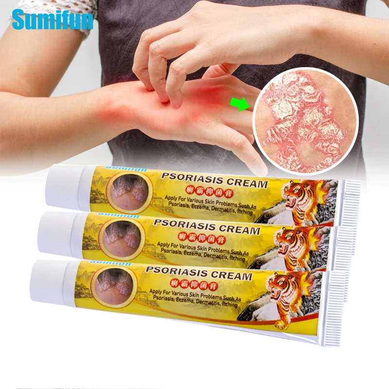 

2 шт., антибактериальный бальзам Sumifun Tiger от зуда