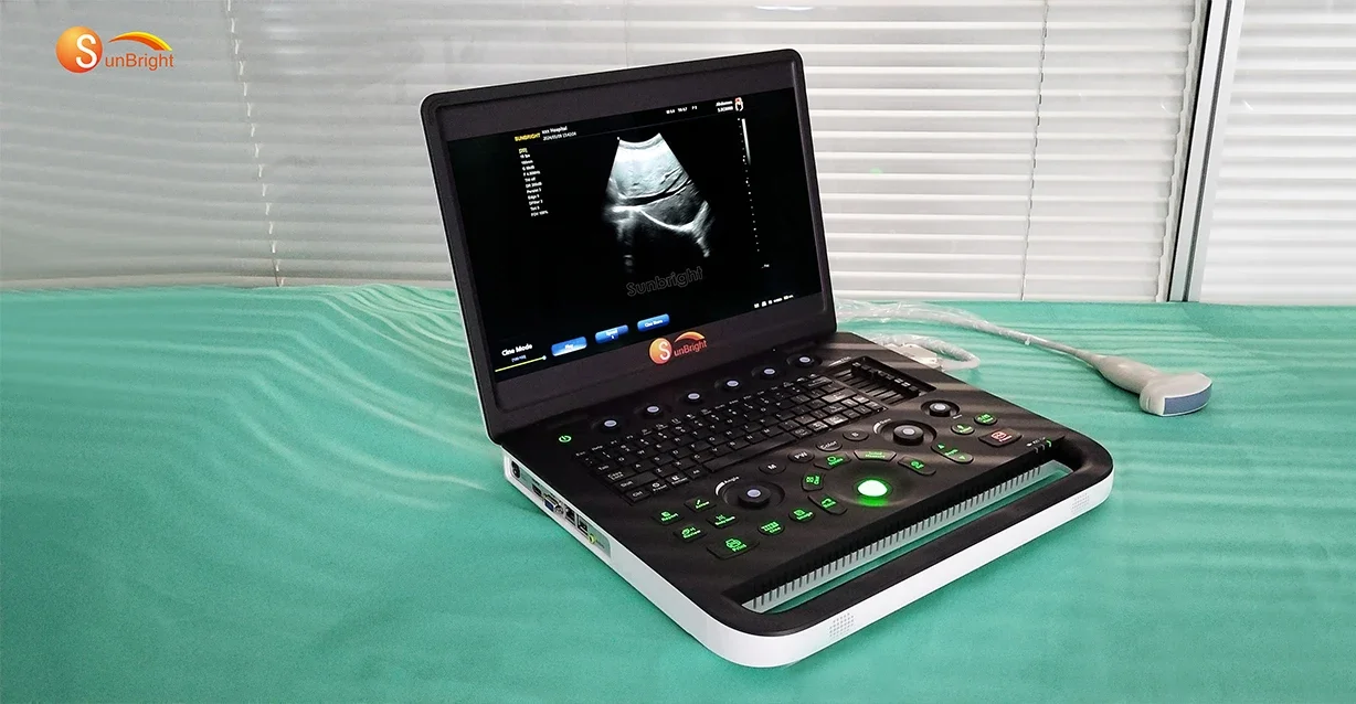 10 1-дюймовый экран дешевый 2D PW ноутбук допплер ультразвуковая диагностическая