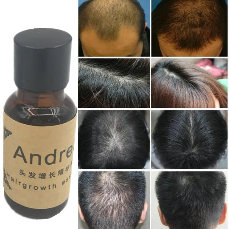 2PCS Ginseng Anti Hair Loss Growth Essence Fast Powerful Ginger Hairdressing Hairs Mask Essential Oil Consolidating - купить по
