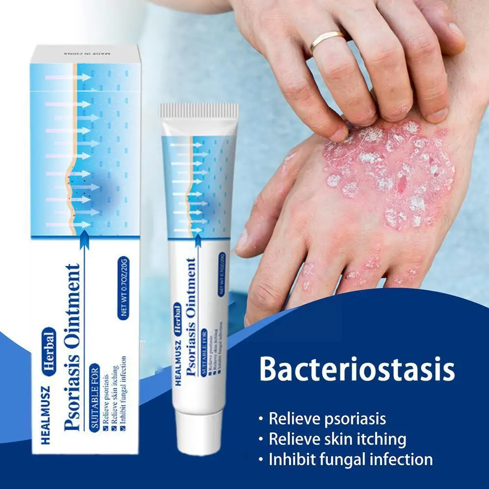

Psoriasis Cream External Skin Ointment Bacteriostatic Cream 20g Ointment Ointment Ointment Psoriasis Herb Antipruritic U7K0