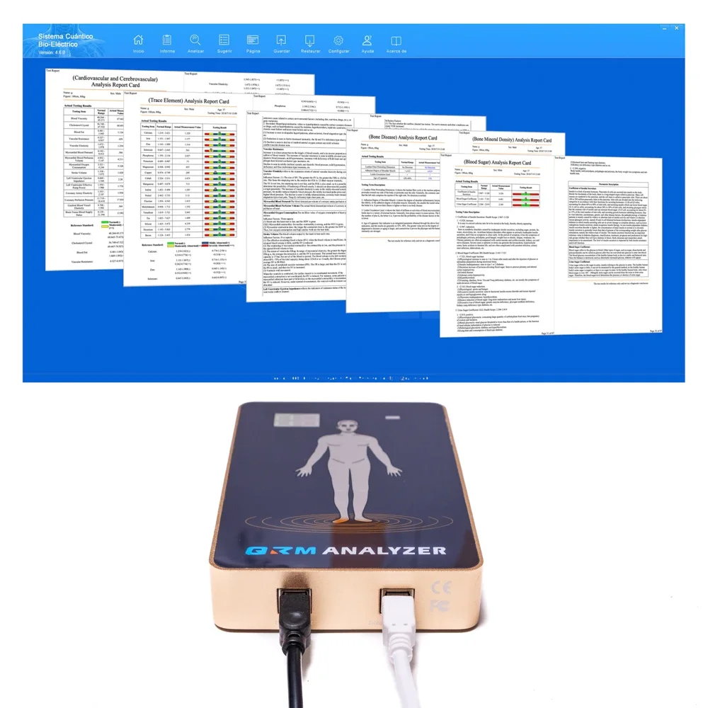 Новый дизайн 9-й автоматический анализ QRMA для сканирования тела