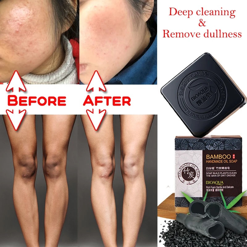 

Vagina Whitening Africa Nigeria Handmade Soap Lighten Dark Bikini Line Bamboo Charcoal Cleansing Soap Remove Dullness Skin Care