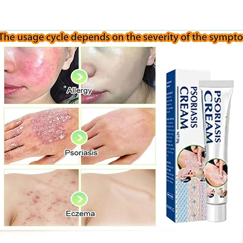 Лидер продаж крем для тела медицинский продукт ухода за кожей облегчение