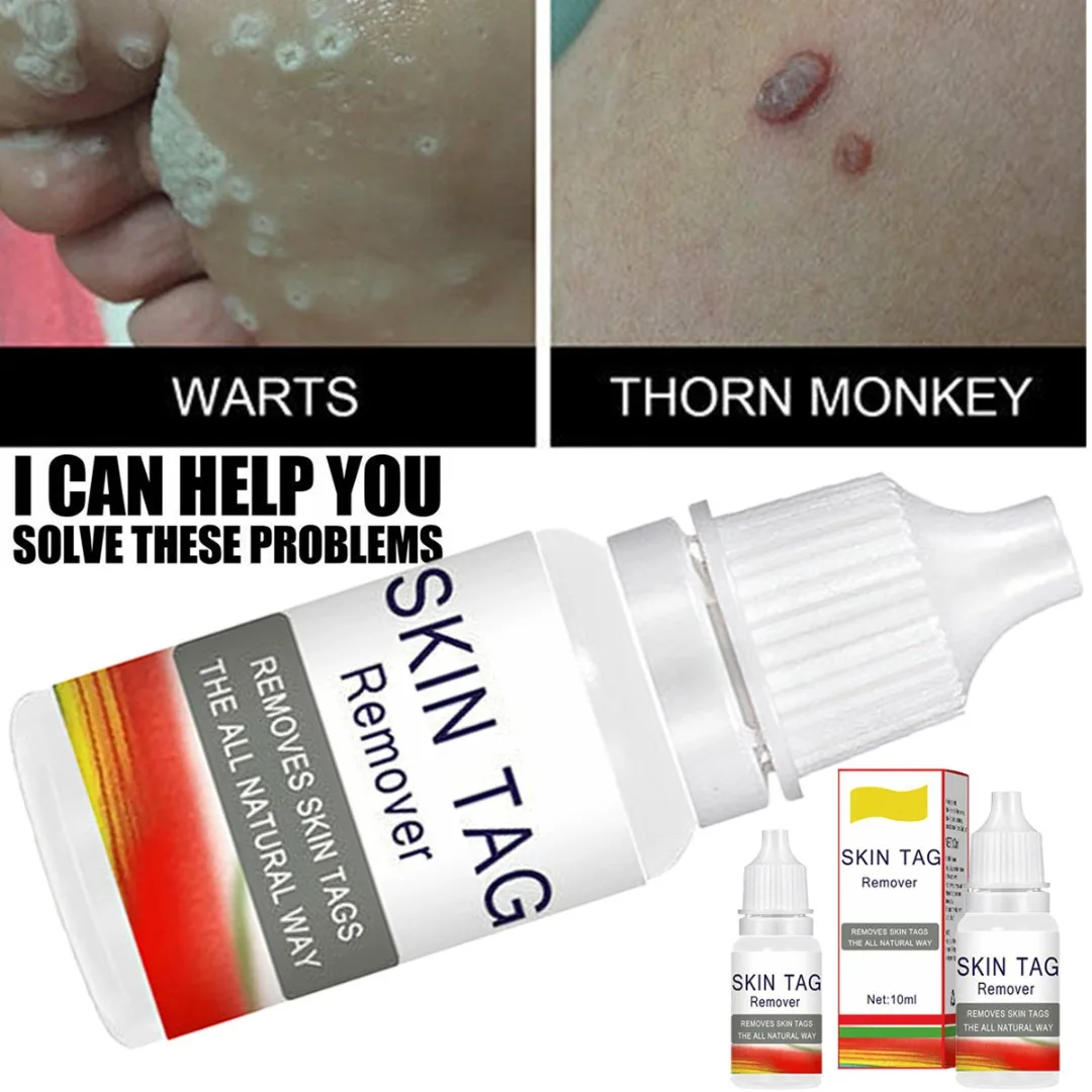 

1 Pc 10ml Effective Skin Tag Removal Natural Liquid for Face Care Mole Callus Gram Warts Foot Remover Treatment Skin Beauty