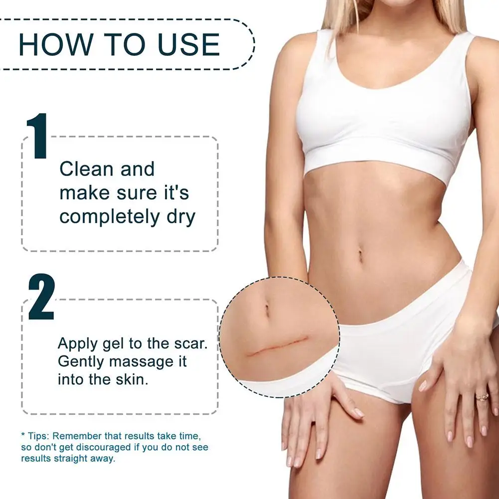 Рисунок 5 - Средство для удаления рубцов после акне