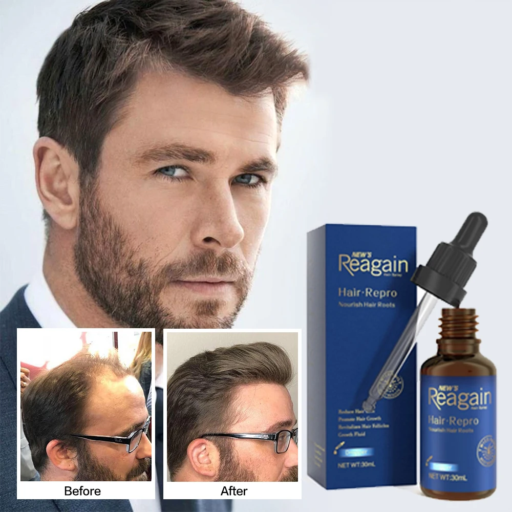 Hair Growth Essential Oil Anti Hair Loss Fast Hair Growth Products Are Suitable For Men And Women To Quickly Regenerate Hair