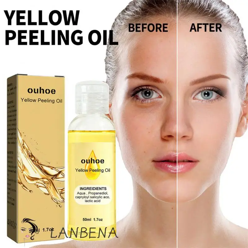 

Removeal Scars 50ml Brightening Skin Care Oil Remove Dryness Mild Care Oil Beauty Products Whiten Brighten Skin Care