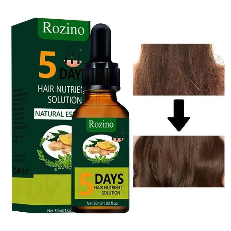 

Organics Ginger Essential Oil Hair Growth Oils Pure Natural 30ml Hair Essential Oils For Nourish Shiny Hair Healthy Hair Care