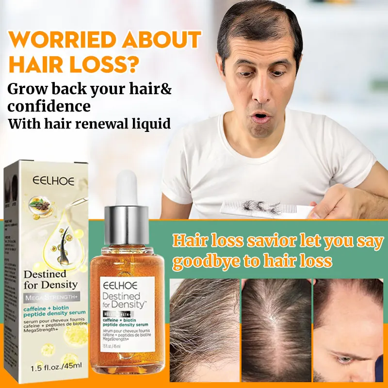 

Hair Follicle Repair Hair Growth Plant Essence Oil Rapid Anti-Haiross Regeneration Sssence Product Treatment Hair Scalp Care