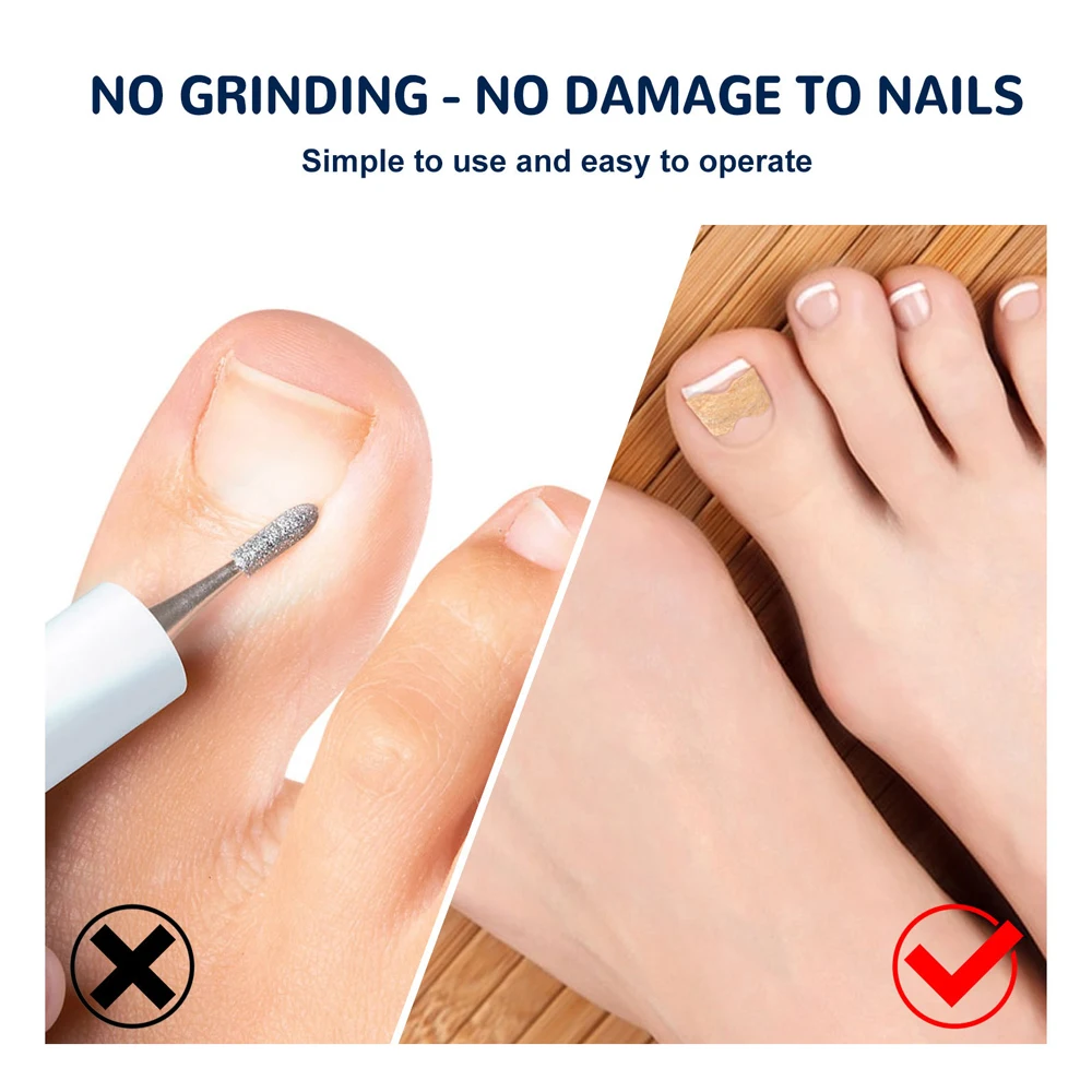 50/100/150 шт. пластыри для коррекции вросших ногтей