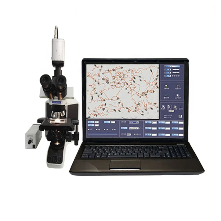 

Veterinary Pig Cow Sheep Horse Dog Animal Sperm Quality Analyzer casa