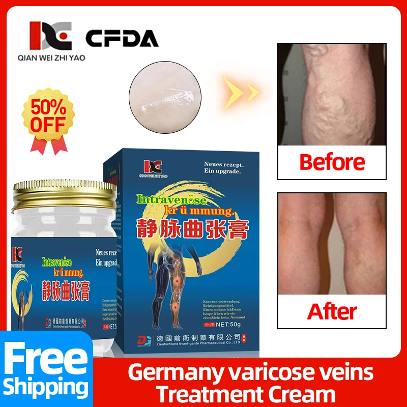 

Germany Varicose Veins Treatment Cream Varicocele Relief Ointment for Spider Legs Varicosity Vasculitis Phlebittis Medicine