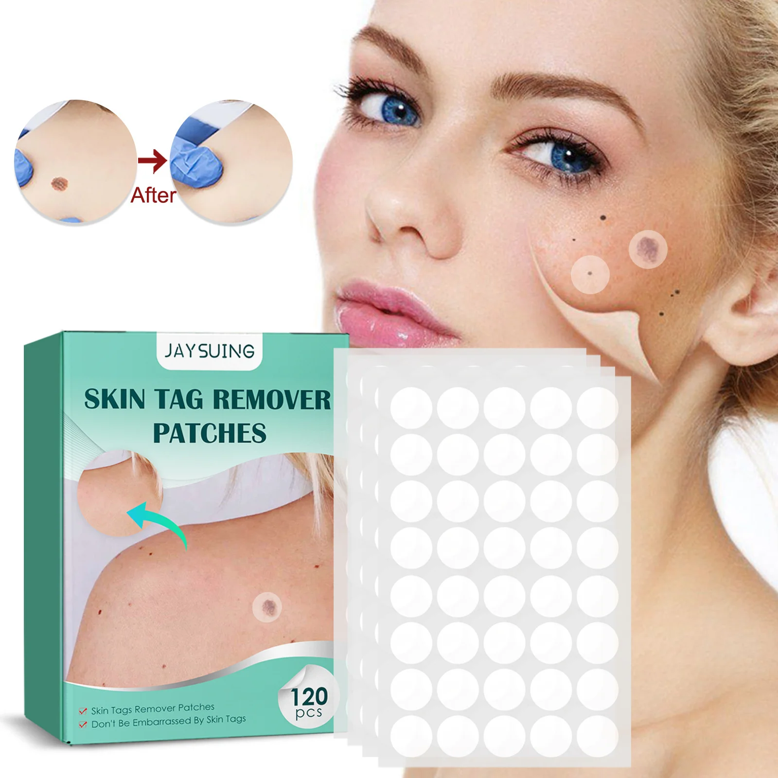 120PCS Warts Remover Patch Skin Tags Pimple Acne Treatments Painless Anti Foot Corn Moles Plaster Skin Care Invisible Stickers