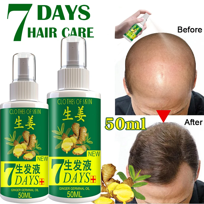 

7-day hair growth spray anti-hair loss strong hair root essence rapid hair growth repair scalp beauty hair care neutral