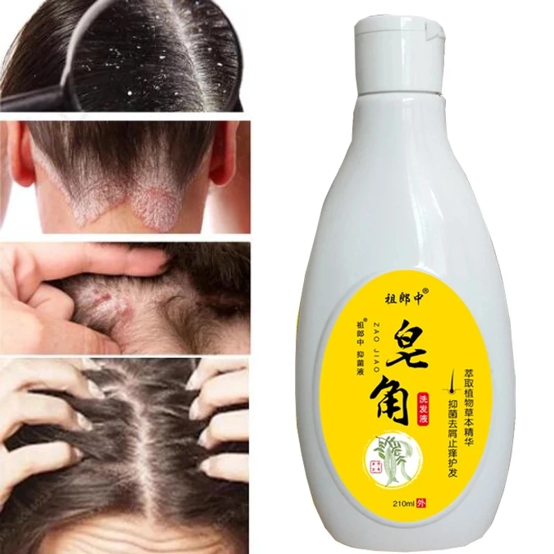 

210ml Scalp Cleansing Shampoo Dandruff Seborrheic Follicles Antibacterial Anti-itching Mites Oil Control Psoriasis Removal Acne