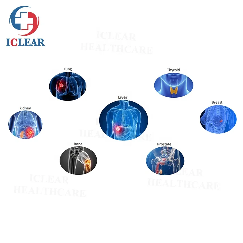 Рисунок 6 - Аппарат для лечения раковой хирургии