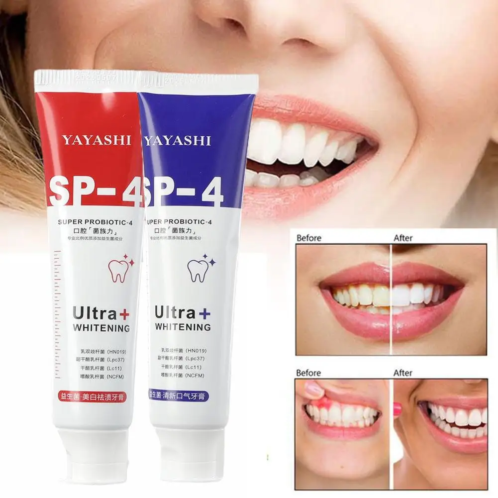 

120g Probiotic Whitening Shark Toothpaste Teeth Whitening Toothpaste Oral Care Toothpaste Fresh Breath Prevents Plaque