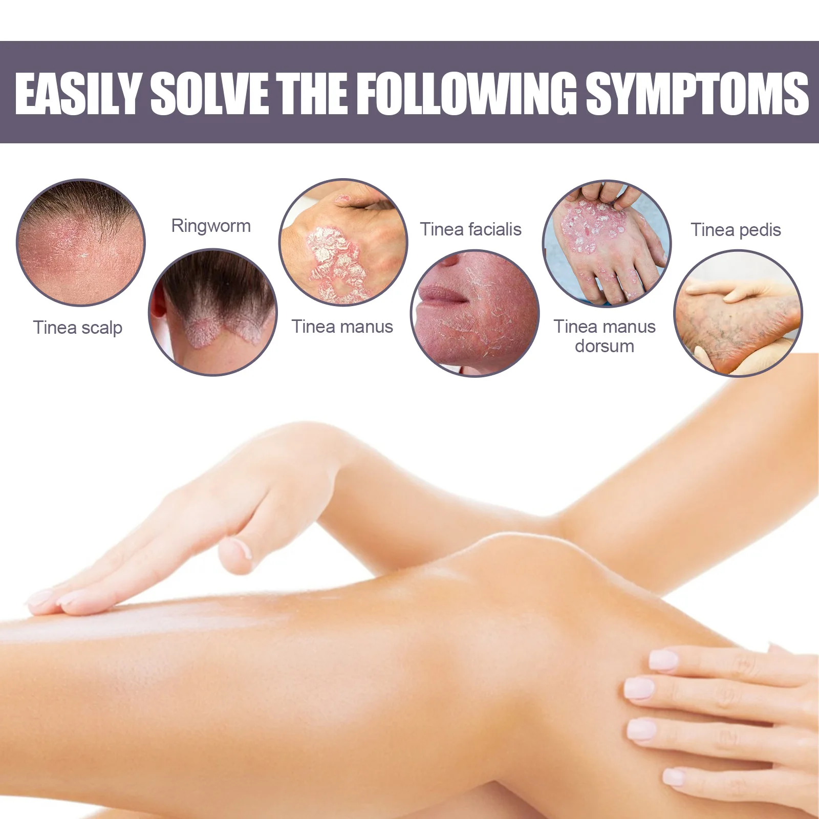 Рисунок 6 - Спрей для лечения псориаза