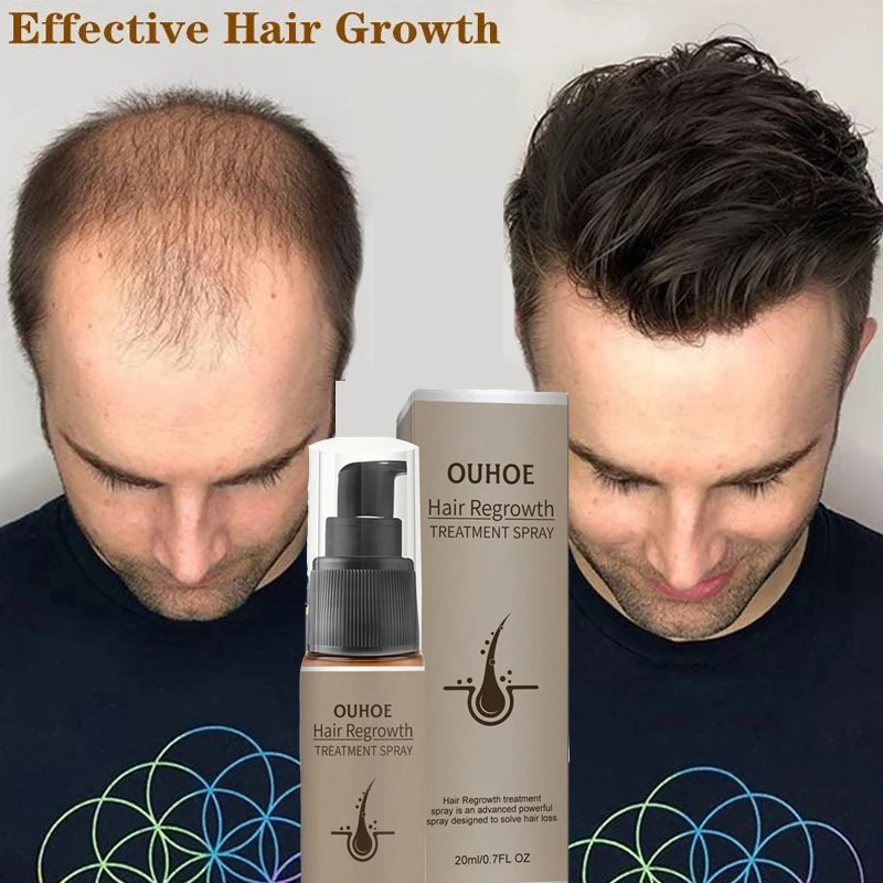 

Fast Hair Growth Spray Oil Products Natural Anti Hair Loss Treatment Scalp Dry Damaged Beard Hair Care Essential Oils Men Women