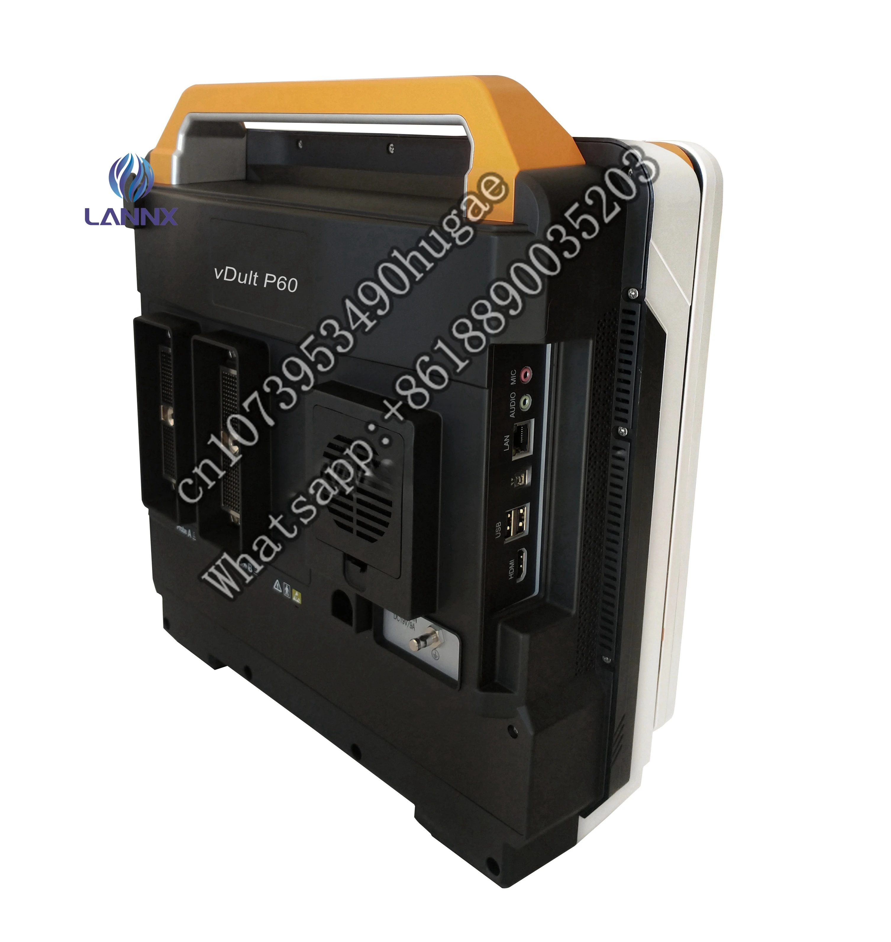 Рисунок 3 - LANNX vDult P60 Цифровой 3D 4D Цветной Допплер