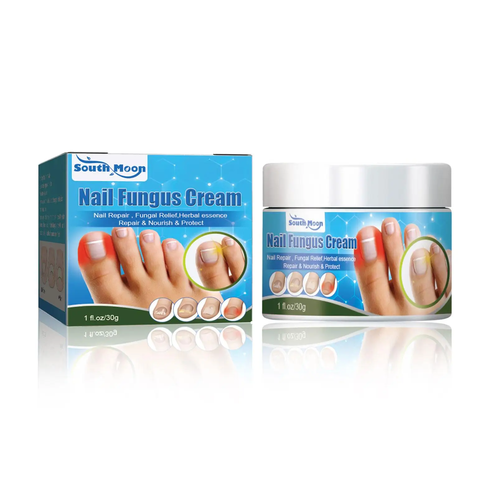 

Chinese Herbal Toe Nail Fungus Treatment Cream Onychomycosis Repair Infection Antibacterial Anti Paronychia Ointment Fungal