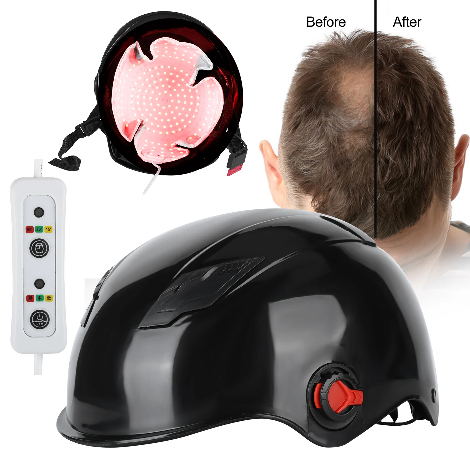 240/256/280pcs Lamp Beads Hair Growth Helmet Hair Loss Treatment Light Therapy Device Black