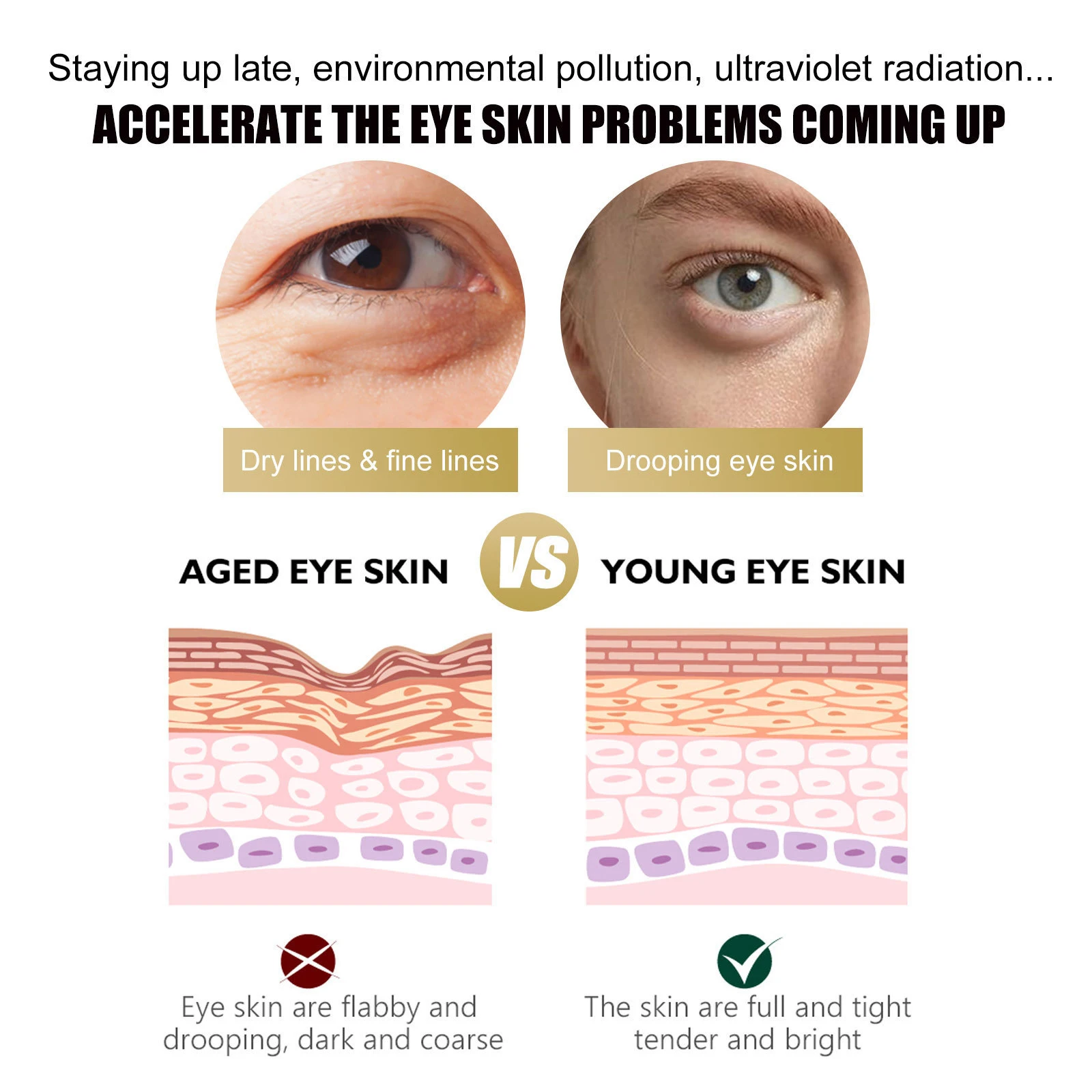 4 шт. крем для кожи вокруг глаз от Тёмных кругов и тёмных