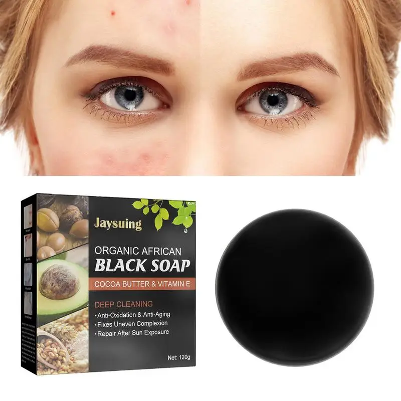 

Face And Body Bar Soap Skincare Handmade Oil Control Whitening Natural Facial Cleanser For Dry Oily Sensitive Skins Pimple