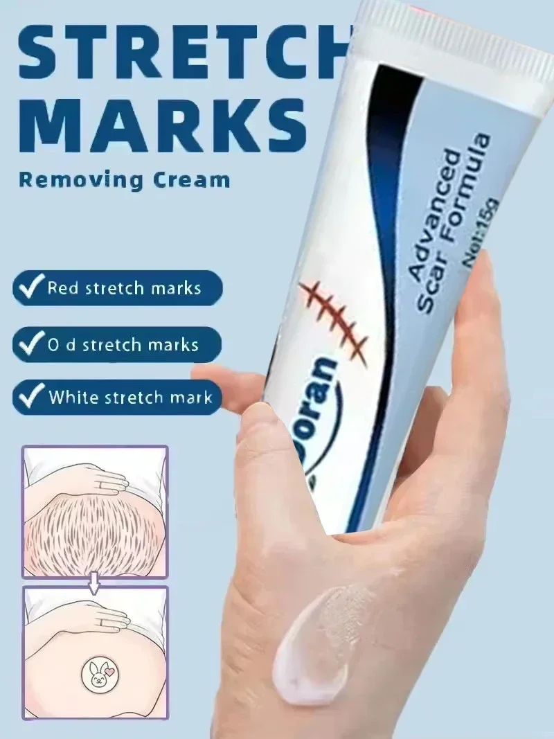 Крем для беременных повышает эластичность нежный уход за кожей после