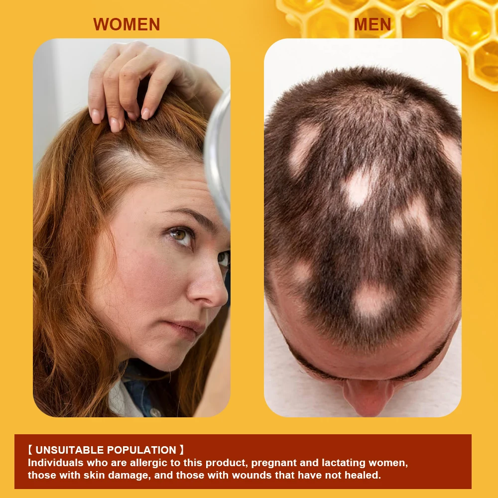 1/3/5/10 шт. Sumifun крем для роста волос алопеция восстановление лысины мазь