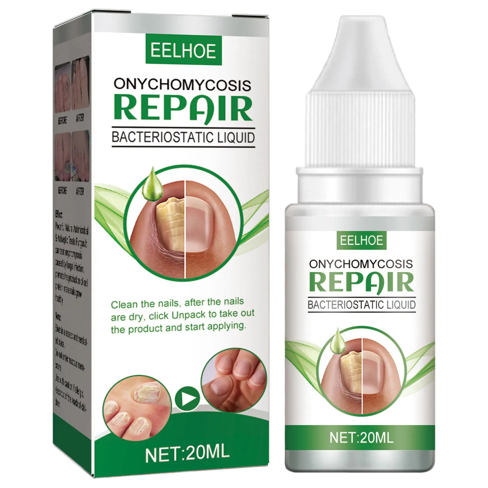 

20ml Nail Fungus Repair Solution Fast-acting Nail Discoloration Treatment for Healthy Straight Nail