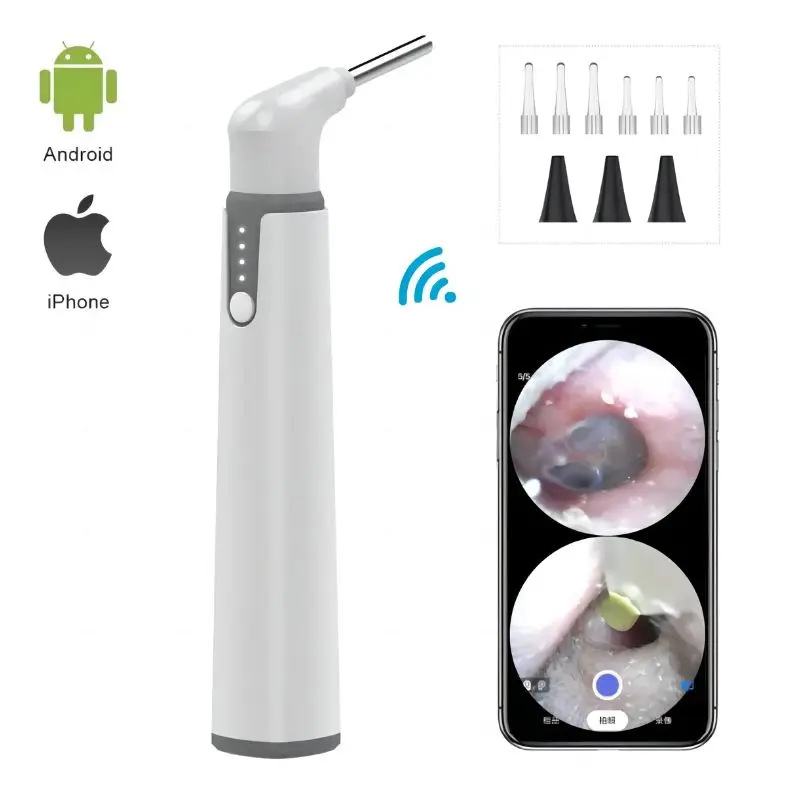 

Ear Camera with Dual View Wireless Otoscope 3.9mm 720P WiFi Ear Scope with 6 LED Lights for Kids and Pets work with IOS Android