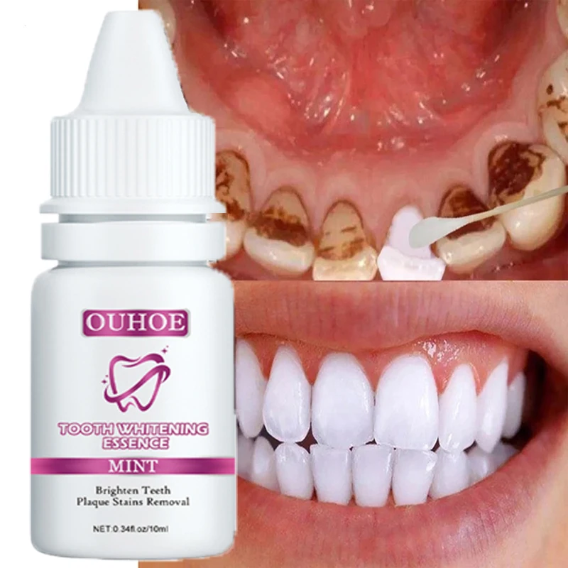 Teeth Whitening Essence Tooth Gel Remove Plaque Stains Tooth Bleaching Cleaning White Teeth Fresh Breath Dentistry Care Tools