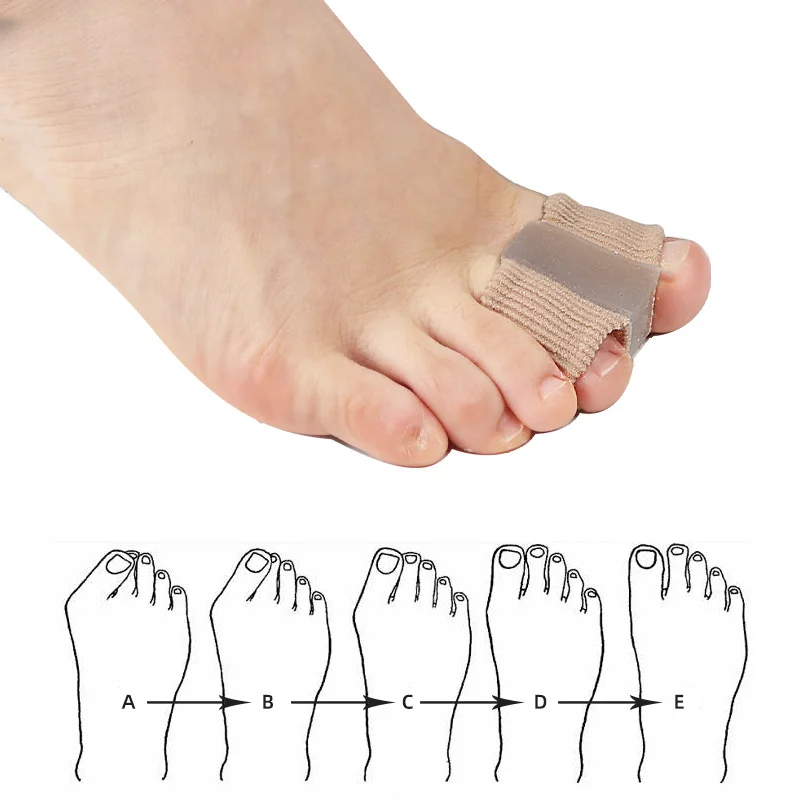 

1Pc Silicone Toe Spreader Finger Separator Bunion Hallux Valgus Corrector Thumb Correction Straightener Foot Care Orthopedic