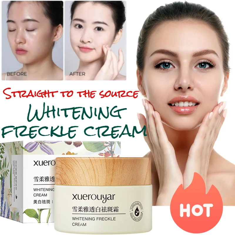 

Small Milk Pot Whitening and Freckle Cream Deep Hydrating Moisturizing Repair Lazy Essence Cream Skin Care Products 30ml