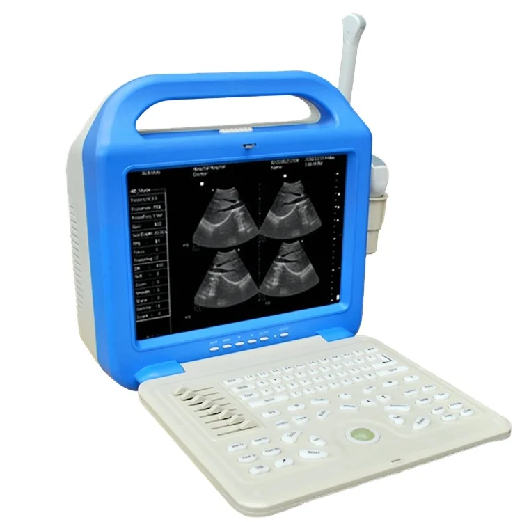 

Hospital Mobile Digital Laptop Ultrasonic Diagnosis Equipment to Human Colour Doppler Ultrasound Scanner