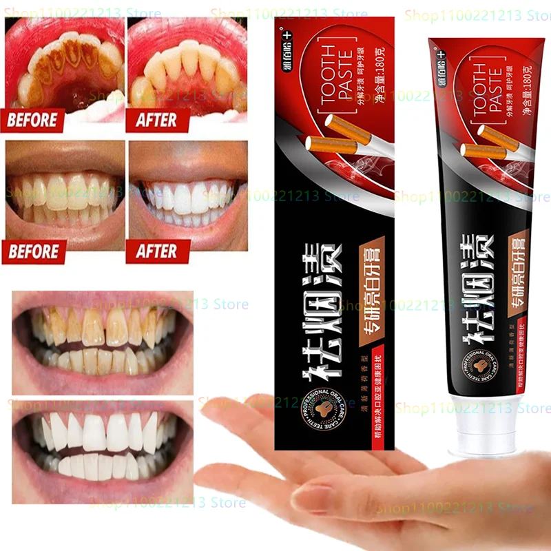 

Remove Smoke Stains, Fresh Mint Fragrance, Anti-cavity, Remove Bad Breath, Adult Toothpaste 180g, Must-have for Tooth Stains