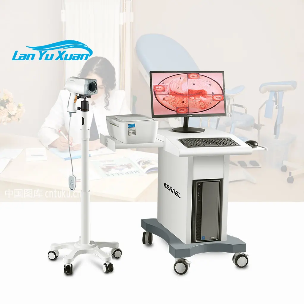 

Kernel KN-2200 Medical Digital Colposcope Video Equipment Gynecological Endoscope Colposcope For Gynecology