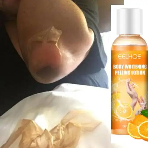 

Peeling Oil Immediate Whitening Peel Peeling Gel Skin Peeling Mask Fnger Knee Armpit Dark Skin Bleaching Lightening Kojic Acid