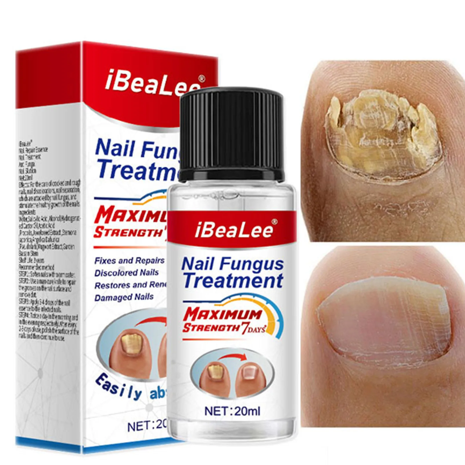 

Отвердитель для ногтей 20 мл, нежный Восстанавливающий раствор для ногтей, восстанавливает слабые ломкие тонкие поврежденные ногти при пожелтении, мутности и обесцвечивании