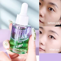 rosemary remove freckle facial serum whitening essence oil removing melanin firming face serum beauty skin care products 30ml