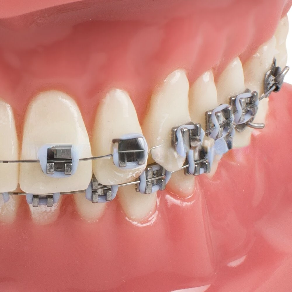 Рисунок 3 - Модель для обучения зубам