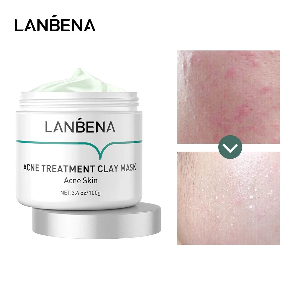 LANBENA Acne Treatment Clay Mask Oligopeptide Acne Masks Mud Face Cream Grease Cleansing Firming Pore Remove Oil Serum Skin Care
