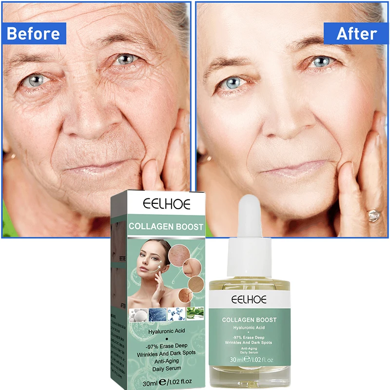 eelhoe Collagen Hyaluronic Acid facial Serum Anti Wrinkles Aging Moisturizing Face Lift Dark Spot Remover Korean Cosmetics 30ML